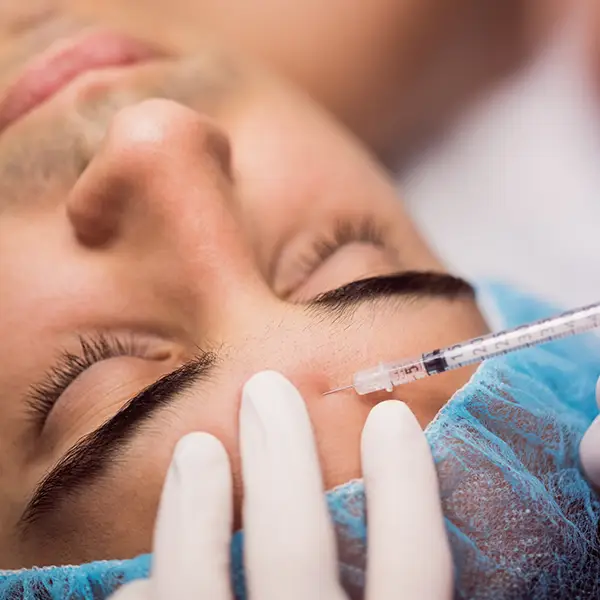 Aplicación de toxina botulínica para suavizar líneas de expresión y prevenir arrugas