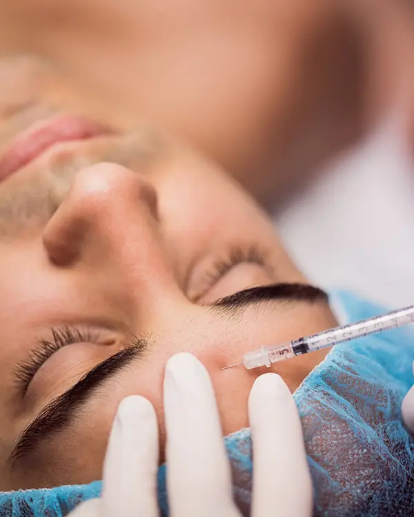 Aplicación de toxina botulínica para líneas de expresión en medicina estética facial